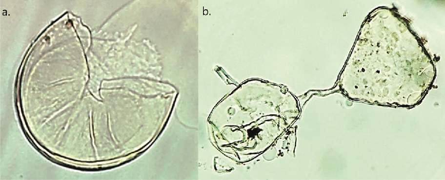 Imágenes microscópicas con aumento 40x de esporas de los HFMA inoculados en solución de alcohol polivinílico-ácido láctico glicerol (PVLG). a) Acaulospora mellea; b) Rhizoglomus irregulare.