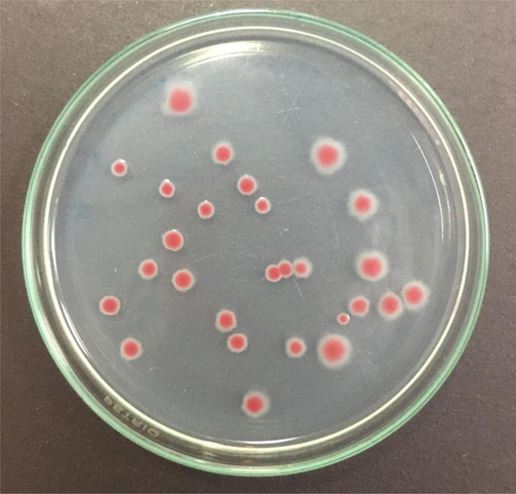 Aislados de R. solanacearum de cepa virulenta en medio TTC.