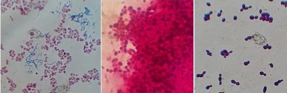 Tinción Gram del consorcio de microorganismos acidófilos. Aumento de 100x