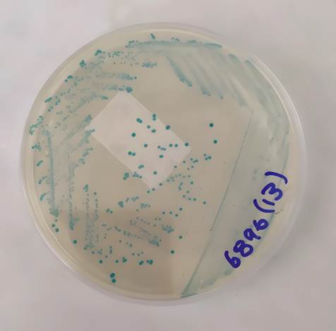 Colonias de E. coli de color azul verdoso en agar TBX+C