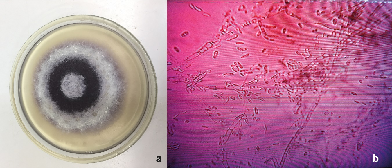 a) Crecimiento de F. solani en medio de cultivo PDA a los ocho días de sembrado en medio, b) Identificación morfológica de F. solani, hifas y macroconidias.