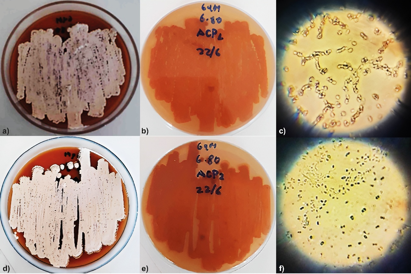 Actinomycetes colonies in pure culture [GYM] and spore microscopy: a) ACP1: aerial mycelium, b) ACP1: diffusible pigment; c) ACP1: spores_1000X, d) ACP2: aerial mycelium, e) ACP2: diffusible pigment; f) ACP2: spores_1000X.