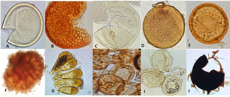 Esporas de HMA encontrados en suelos rizosféricos asociados al cultivo de mango cv. azúcar en los municipios de Santa Marta y Ciénaga. A. Acaulospora scrobiculata (Trappe); B. Acaulospora excavata (Ingleby & C. Walker); C. Cetraspora pellucida (Oehl, F.A. Souza & Sieverd.); D. Gigaspora margarita (W.N. Becker & I.R. Hall); E. Glomus microcarpum (Tul. & C. Tul); F. Glomus sinuosum (R.T. Almeida & N.C. Schenck); G. Glomus taiwanense (R.T. Almeida & N.C. Schenck); H. Rhizoglomus intraradices (Sieverd., G.A. Silva & Oehl); I. Rhizoglomus fasciculatum (G.A. Silva & Oehl); J. Septoglomus constrictum (G.A. Silva & Oehl).